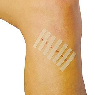 STERI STRIPS